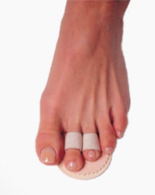 Budin Toe Positioning Splints for Hammer Toes